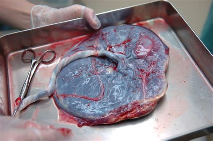 'Teen Mom' Star Eats Her Own Placenta!