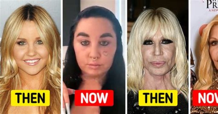 10 Celebrity Transformations That Shocked Everyone