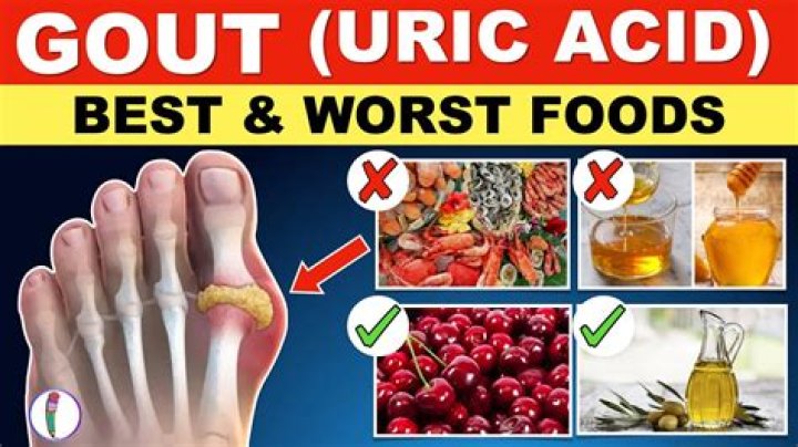 Are all nuts bad for gout?