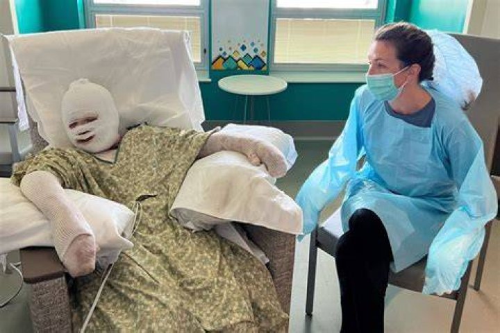 
Barrett McKim,12, After his science experiment went off, suffered third-degree burns 