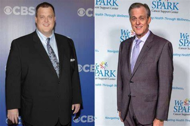 Billy Gardell Illness And Health Update: Did He Have Weight Loss Surgery, How Much Weight Did He Lose?