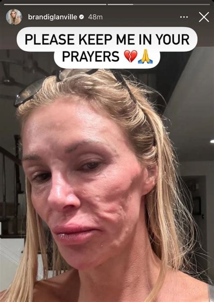 Brandi Glanville accused of boning her best friend’s ex-husband for publicity