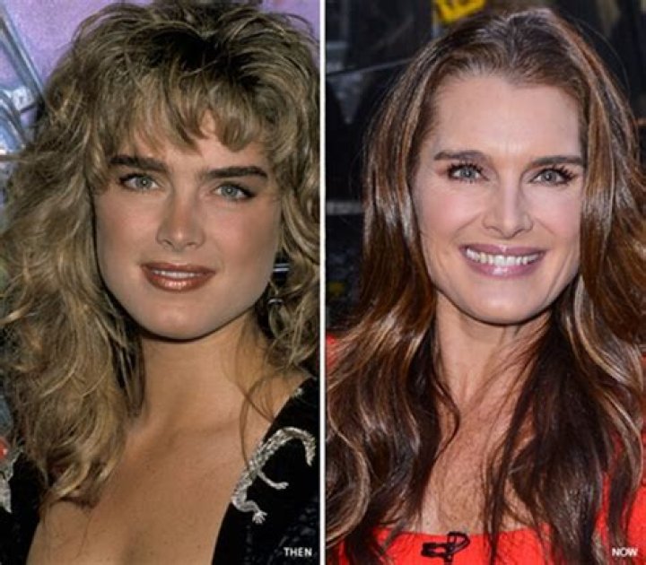 Brooke Shields Nose Job, Plastic Surgery Before And After