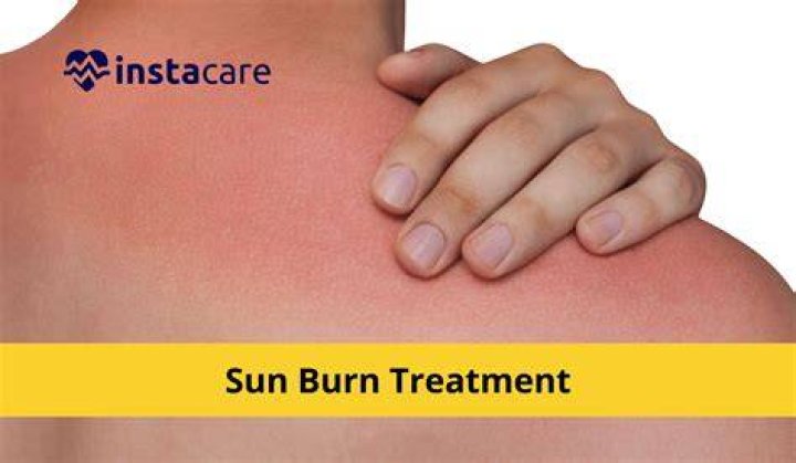 Can a cactus recover from sunburn?