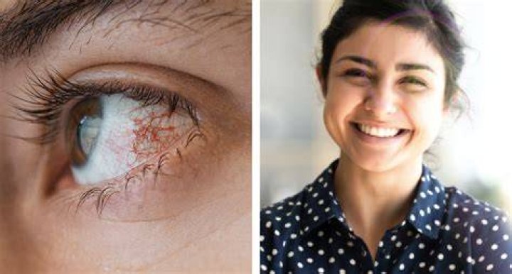 Can chilli damage your eyes?