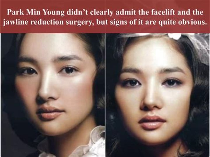 Choi Min-Young Plastic Surgery: Before And After Photos