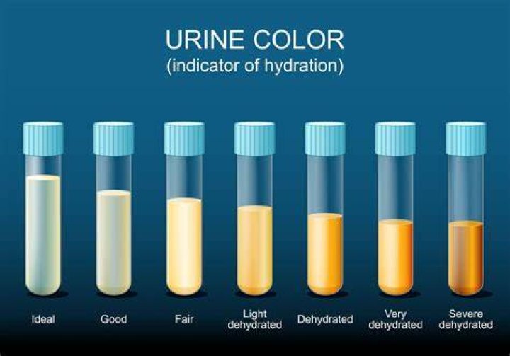 Doctor warns about overhydration, says ‘clear pee’ should not be the goal