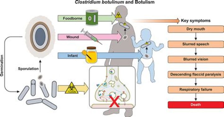 Does Clostridium Sporogenes need oxygen?