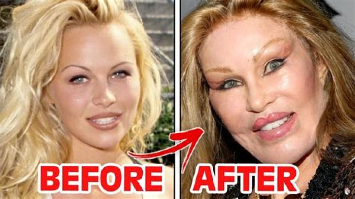 Gross! '90 Day Fiancé' Reveals Botched Plastic Surgery
