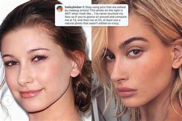 Hailey Baldwin on accusations of plastic surgery: ‘I’ve never touched my face’