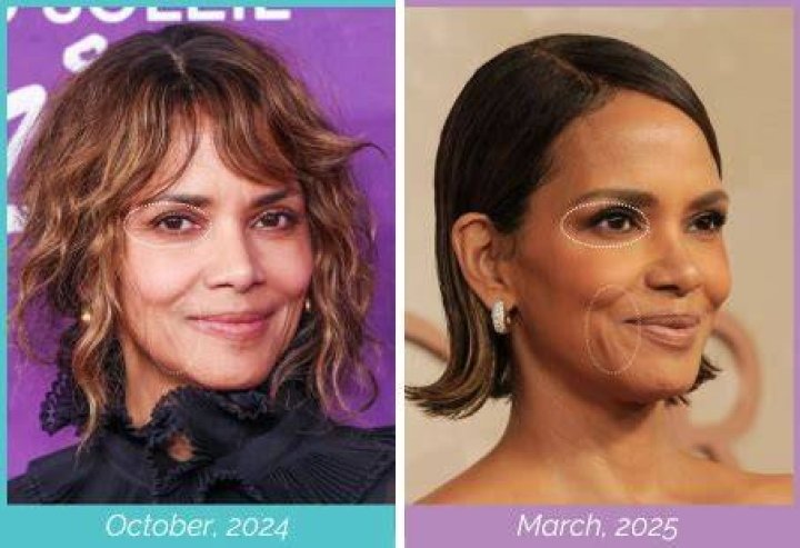 Halle Berry on plastic surgery: ‘it’s almost like crack that people are pushing on you’