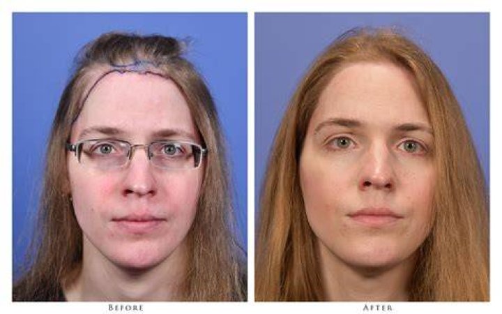 
Hannah Tubbs Before Transition Surgery- Trans Molester James’ Murder Sentence 
