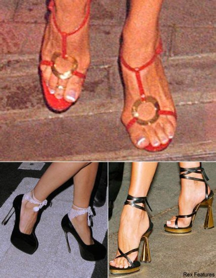 Have High Heels Really Ruined Victoria Beckham’s Feet?