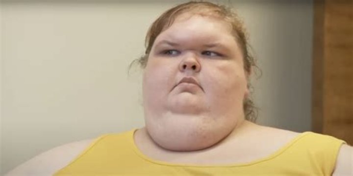 How did American singer Carnie Wilson treat her Bell’s palsy? Know about her sustained fight against excessive weight!