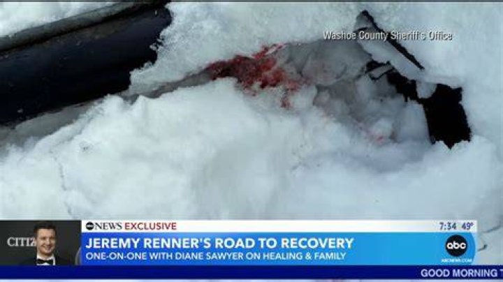 
Jeremy Renner Says He Broke Over 30 Bones In The Snowplow Accident 