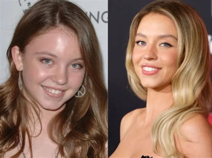 Kady Mcdermott Surgery: Did She Get Boobs Job Done? Before And After Pics