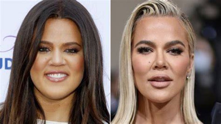 Khloe Kardashian had post-covid hair loss: ‘it was really a struggle’