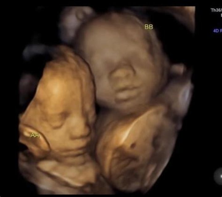 Leah Messer's Sister Shares New Ultrasound Of Twins!