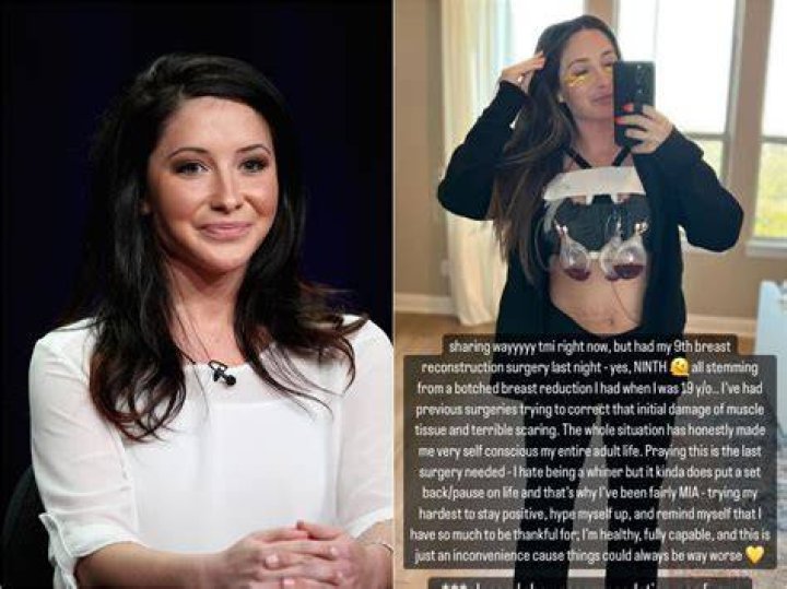 Levi Johnston’s sister: Bristol Palin had breast reduction & liposuction