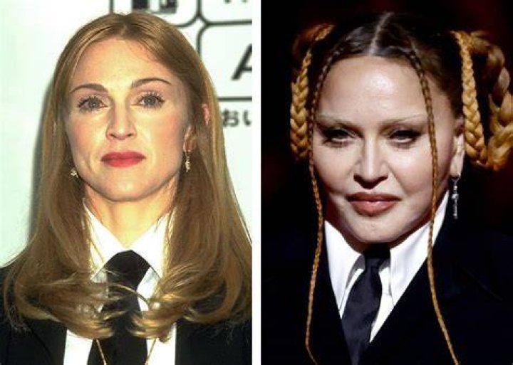 Madonna: ‘Look how cute i am now that swelling from surgery has gone down. Lol’