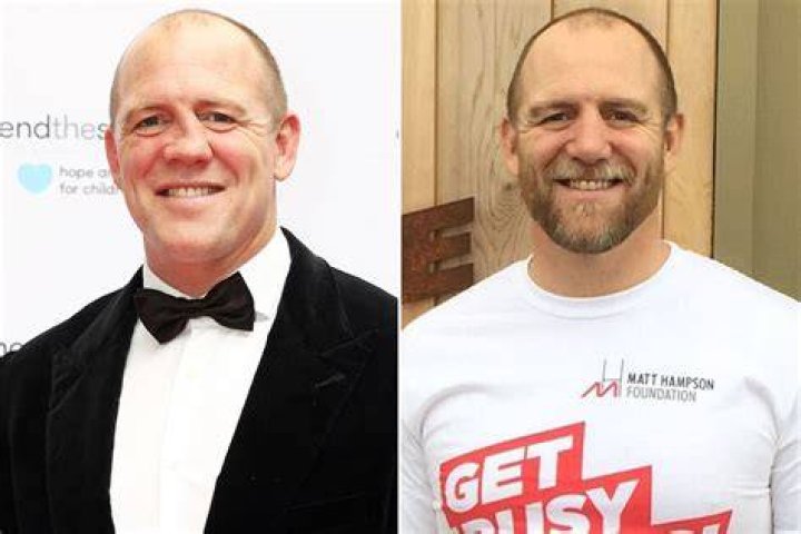 Mike Tindall finally fixed his crazy-crooked nose, now looks crazy-hot