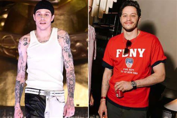 Pete Davidson is getting all his tattoos removed, says it will take two more years