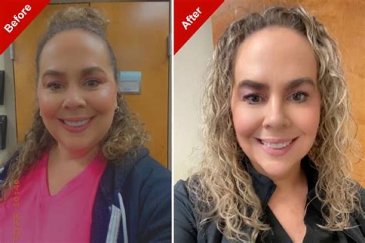 Shay Mitchell Weight Loss 2023 – Before And After Photos
