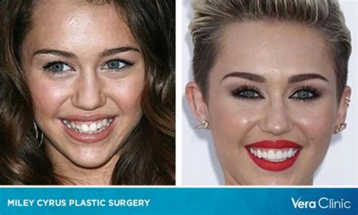 Tish Cyrus Plastic Surgery: Before And After Photos