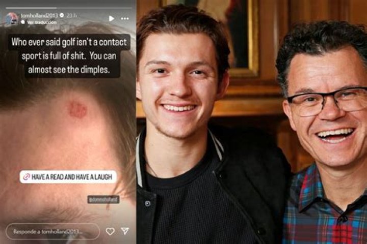 Tom Holland got hit in the forehead by a golf ball, was saved by his ‘wooly hat’