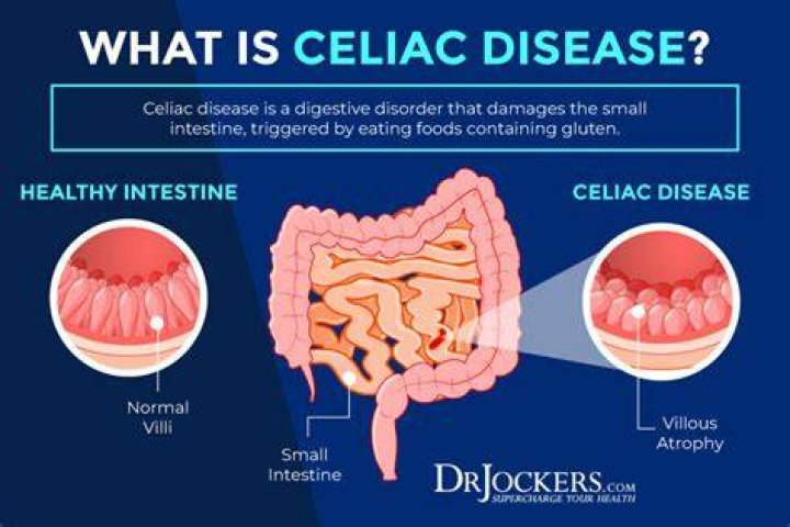 Why does celiac disease cause Steatorrhea?