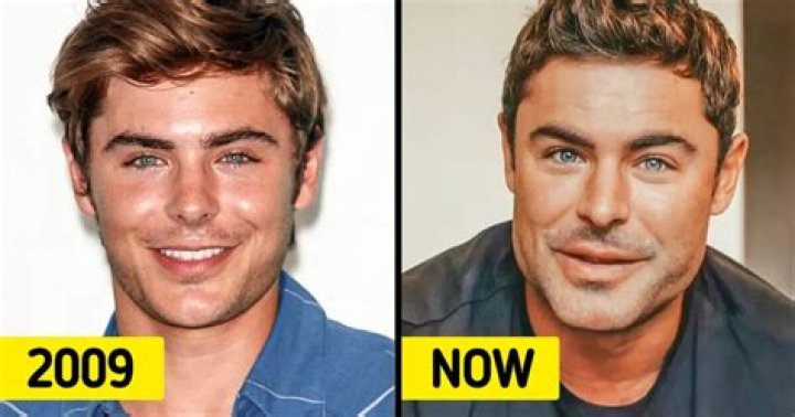 Zac Efron's 'unrecognizable' face after freak accident nearly killed him